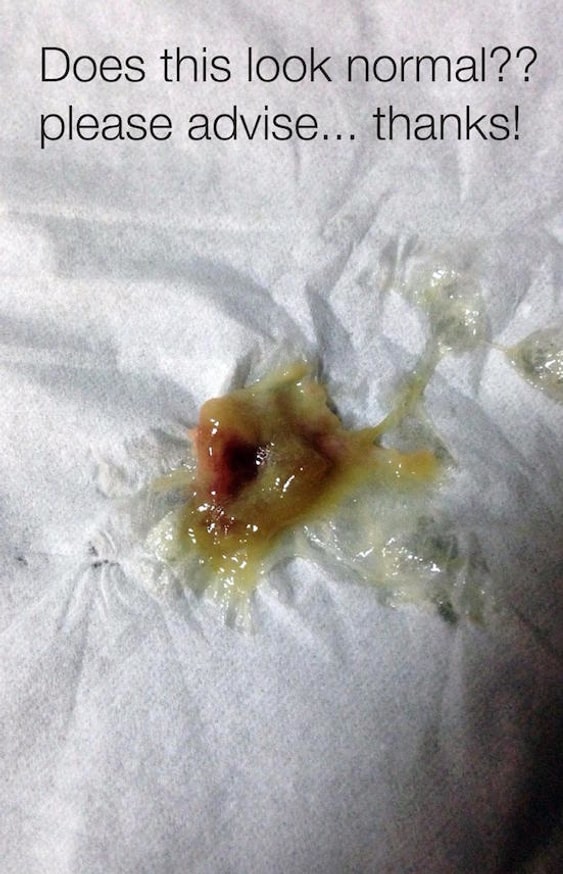 Does This Look Normal??