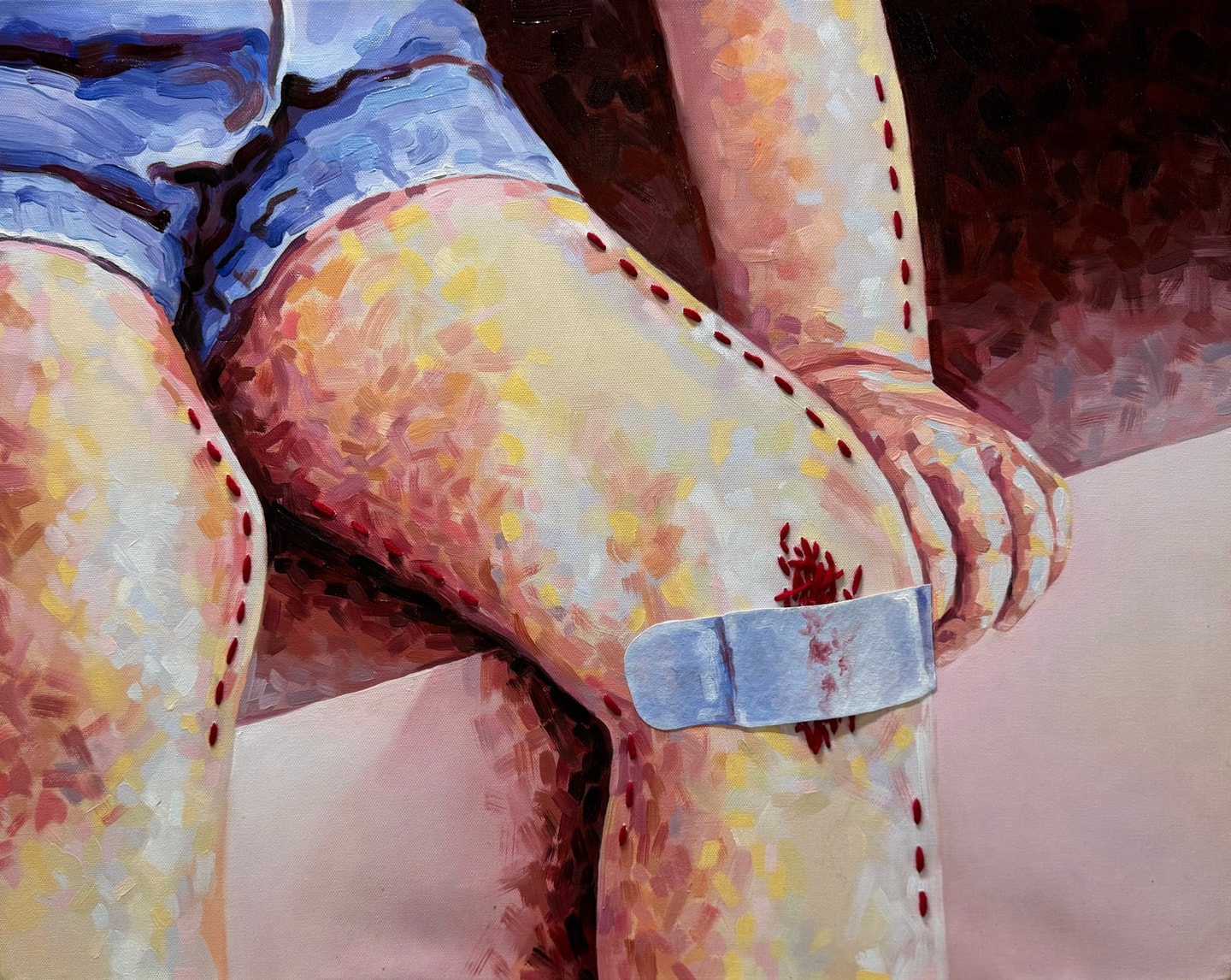 Multimedia painting of an injured knee. Physical red thread is stitched into contours of limbs as well as in a pile under the bandage on the knee.
