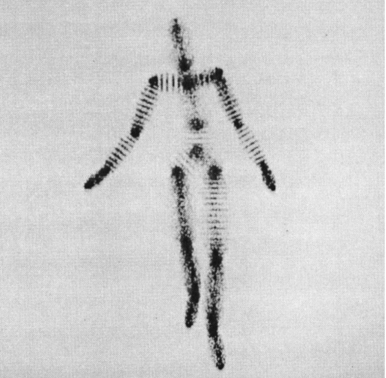“The ‘Cloud person’ with one random variable,” 1983. Published in Delle Rae Maxwell, “Graphical Marionette: A Modern-Day Pinocchio” (master’s thesis, MIT, 1983).