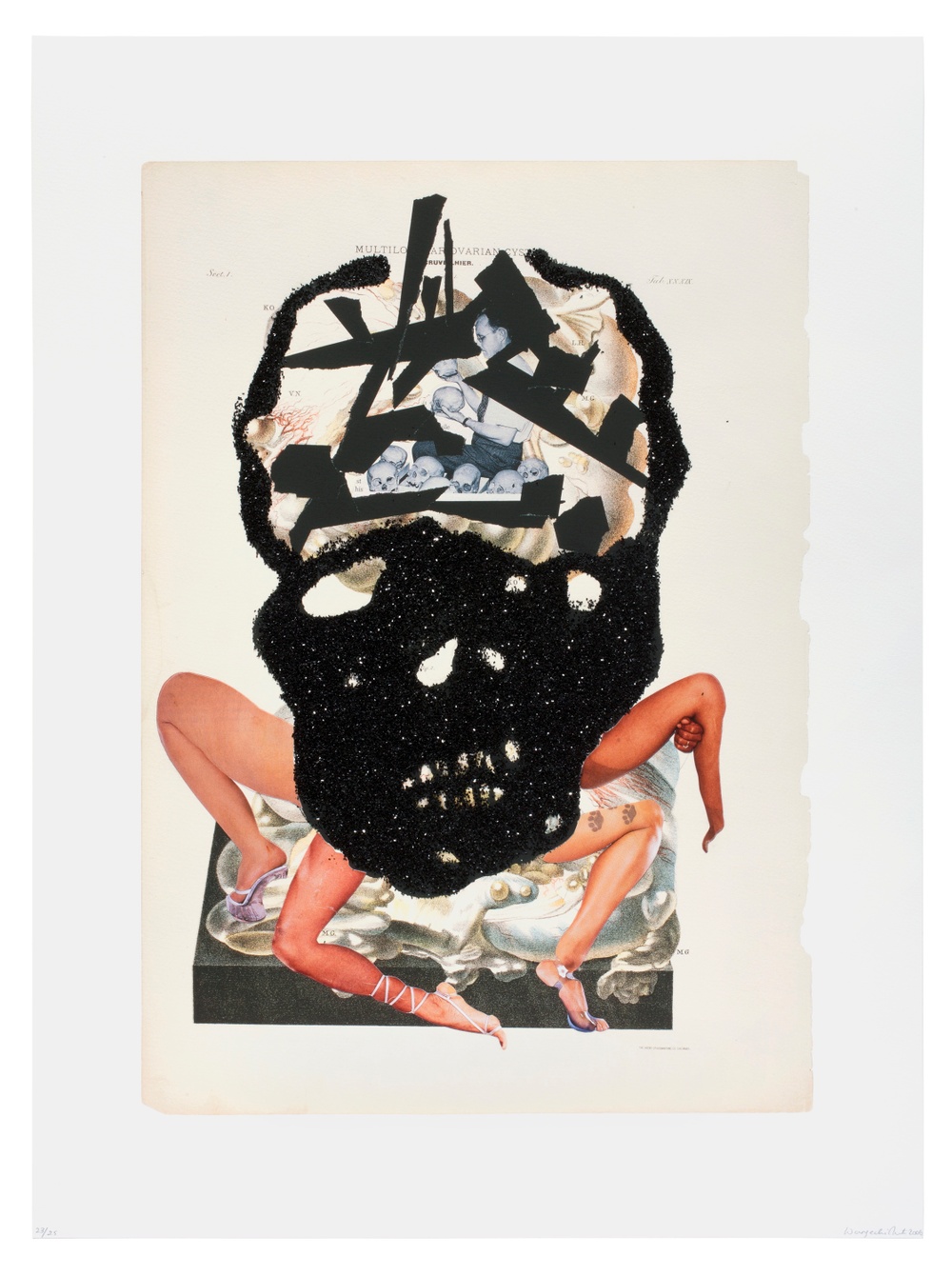 Collaged image of women’s legs cut out from a magazine over a copy of a medical drawing with a big scull over the top made from black glitter.