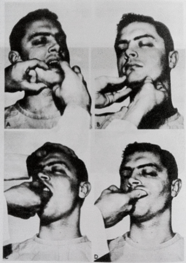 Facial Fractures Shirt [Large]