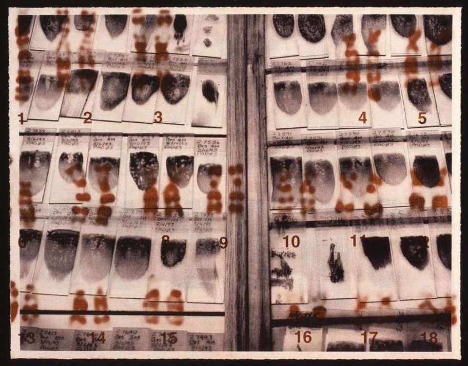 Catherine Wagner_Biogenetics Lab Suite re_Search Bone Marrow Smears with chromosomes.jpg