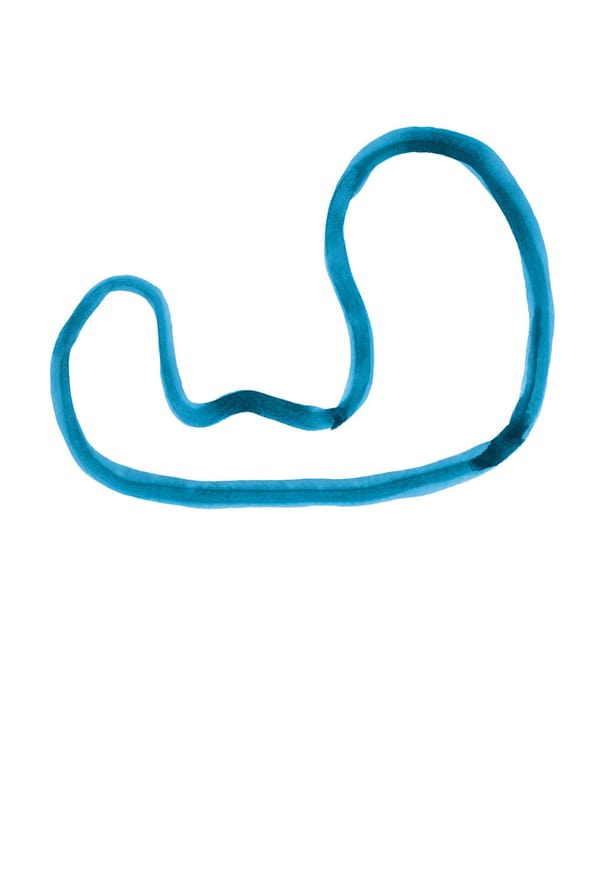 10 lanci di fascia elastica (10 launches of an elastic band) thumbnail 2