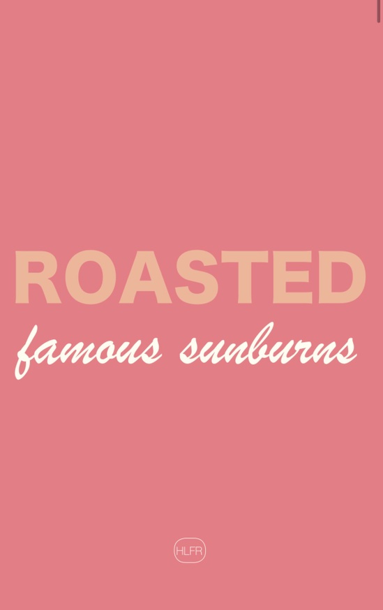 Roasted: Famous Sunburns