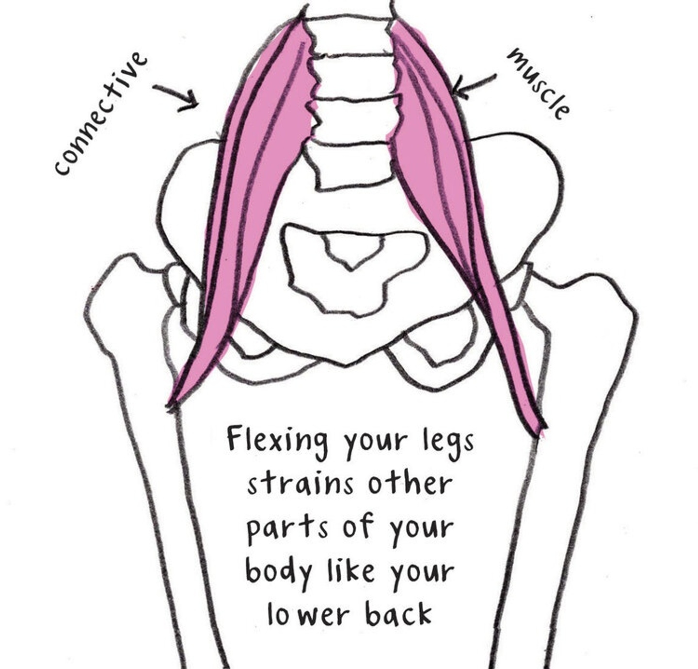 Line drawing of pelvis showing muscles that get strained by bad posture.