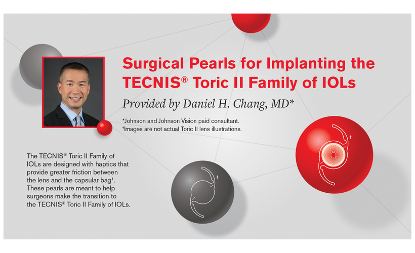 Surgical Pearls for Implanting the TECNIS® Toric II